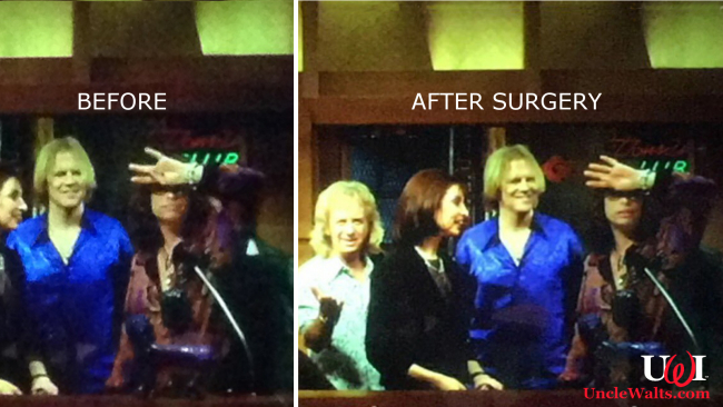 Steven Tyler, before and after finger reattachment surgery. Photo from reddit & @cabel via Twitter.